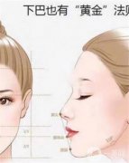 隆下巴可以永遠(yuǎn)不取下來嗎