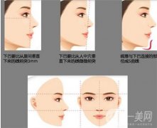 墊下巴手術(shù)后腫脹需要多長時(shí)間才能消腫