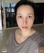 我以前做過(guò)鼻子整形，但我不滿意
