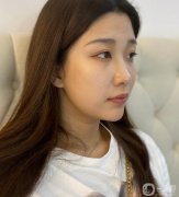 我也想了很久，決定過來做一個(gè)黃金微雕吸脂來解決我的問題