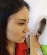 大家好，我終于下定決心做我的鼻子了