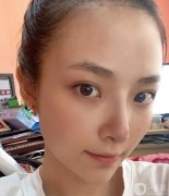 雖然從小到大的朋友都說我長得好看，但我總是對自己的鼻子不滿意
