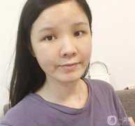 臉部的腫脹正在慢慢減輕，淤青也在消失，越來越正常