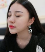 因?yàn)槲业哪槻皇呛芰Ⅲw，醫(yī)生也建議我在打填一個(gè)玻尿酸
