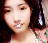用了20多年，今年終于決定割雙眼皮了