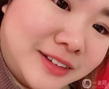 牙齒是人體的重要組成部分，整潔潔白可以提升人的整體體質(zhì)，讓微笑時更有感