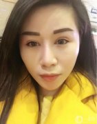 一直想做雙眼皮手術(shù)，但還是猶豫不決，因為這雖然是小手術(shù)，但畢竟還是在臉