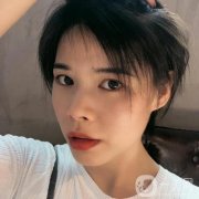現(xiàn)在可以看到恢復(fù)得相當(dāng)不錯(cuò)，整個(gè)臉真的是越來越有立體感了