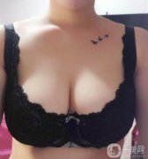 在嚴(yán)重的情況下對(duì)女性泌乳后期也有一定的影響，所以副乳切除是重要的