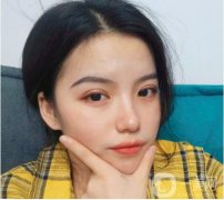 我終于下定決心做雙眼皮了，其實(shí)我想了很久，挑了很多醫(yī)院，看了很多案例，