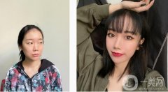 雖然我的眼睛在單眼皮里應(yīng)該比較大，雖然大，但是沒(méi)有層次感
