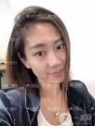雖然現(xiàn)在做雙眼皮手術(shù)不是什么大手術(shù)，甚至可以說(shuō)十有八九做了雙眼皮