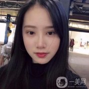 做雙眼皮手術(shù)前，我心里很掙扎，怕沒(méi)有做好反倒毀容了