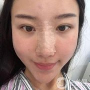這個(gè)丑鼻子降低了我的面值，我想做手術(shù)