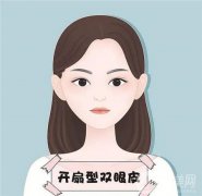 割雙眼皮可能存在哪些隱患