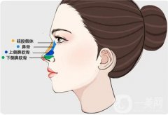隆鼻術(shù)后的禁忌癥有哪些?