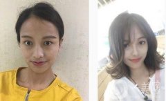 鼻子本身不太好看，一直想做鼻子，但是因?yàn)槭莻€(gè)很糾結(jié)的人，一直糾結(jié)