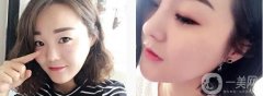 看到那種挺翹的鼻子，感覺(jué)特別好看，很立體也很襯臉