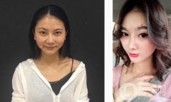 比如我的鼻子，我的鼻子，我的鼻梁都比較低，但是從正面看沒有問題，但是從