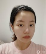 鼻子很大，整個(gè)鼻子都很短