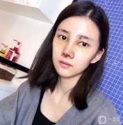 朋友經(jīng)常說(shuō)我的鼻子，說(shuō)我的鼻子好像不發(fā)達(dá)