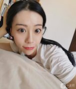 我做線(xiàn)雕的恢復(fù)期很短，別人基本看不到，靜靜的就變美了