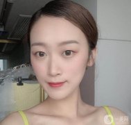 當(dāng)我去打瘦臉針時，醫(yī)生說我的臉實際上是多肉的，不是因為咬肌