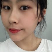 我從小就是肉肉的臉，每次都很煩