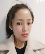 我一直想做雙眼皮手術，因為眼睛真的很影響我的面值