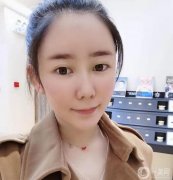 現(xiàn)在臉很自然，填充的部分也很飽滿