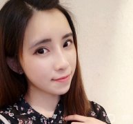 后來(lái)聽(tīng)說(shuō)玻尿酸隆鼻效果也不錯(cuò)，沒(méi)有恢復(fù)期，于是對(duì)比了幾家醫(yī)院，選擇了韓