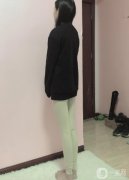 手術(shù)前，我了解了很多醫(yī)院和醫(yī)生的抽脂技術(shù)