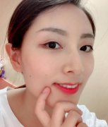 在做線雕項目之前，我一直以為埋線的推廣只是針對三四十歲的女性，所以二十