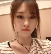 在埋線提升的第15天，到現(xiàn)在為止，感覺效果很好