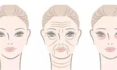 30歲有抬頭紋正常嗎