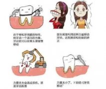 矯正牙齒需要花多少錢(qián)