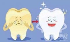 快速解決牙黃的小妙招