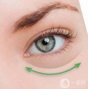 眼袋下垂陰影難看？用對方法輕松解決！