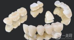 全瓷牙套多少錢一顆價格表2024版，國產(chǎn)和進口品牌的價位范圍對比