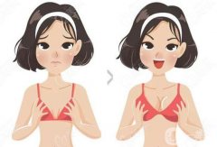 隆胸大概需要多少錢？價格費用表查詢_注意事項、前后對比分享