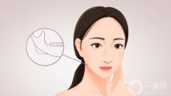 下頜角磨骨手術(shù)需要多少錢？危險嗎？全新價格表_注意事項來襲