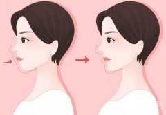 凸嘴焦慮？別再被審美束縛！學(xué)會(huì)這些，讓特色變優(yōu)勢(shì)