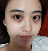 熬夜一時(shí)爽，一直熬夜顏值暴跌！拯救你的肌膚，告別“節(jié)后焦慮”
