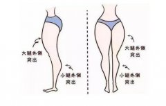 抽脂減肥價(jià)格一覽表2024，抽脂減肥安全性一次了解