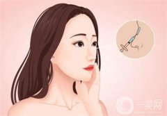 北大深圳醫(yī)院隆鼻案例分享！附崔永言、李天石醫(yī)生專業(yè)擅長一覽