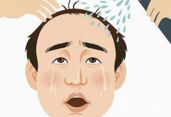 紋發(fā)際線和植發(fā)哪個(gè)好？哪個(gè)才是你的頭部美觀救星？一文告訴你！
