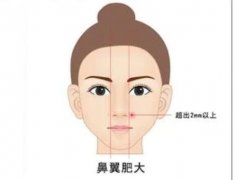 鼻綜合感染的應(yīng)對與預(yù)防措施