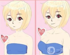 副乳切除術(shù)是否會影響乳房？