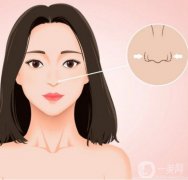 鼻孔縮小手術(shù)是否安全？是否有風(fēng)險(xiǎn)