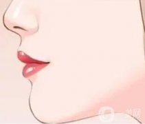玻尿酸注射隆鼻的注意事項